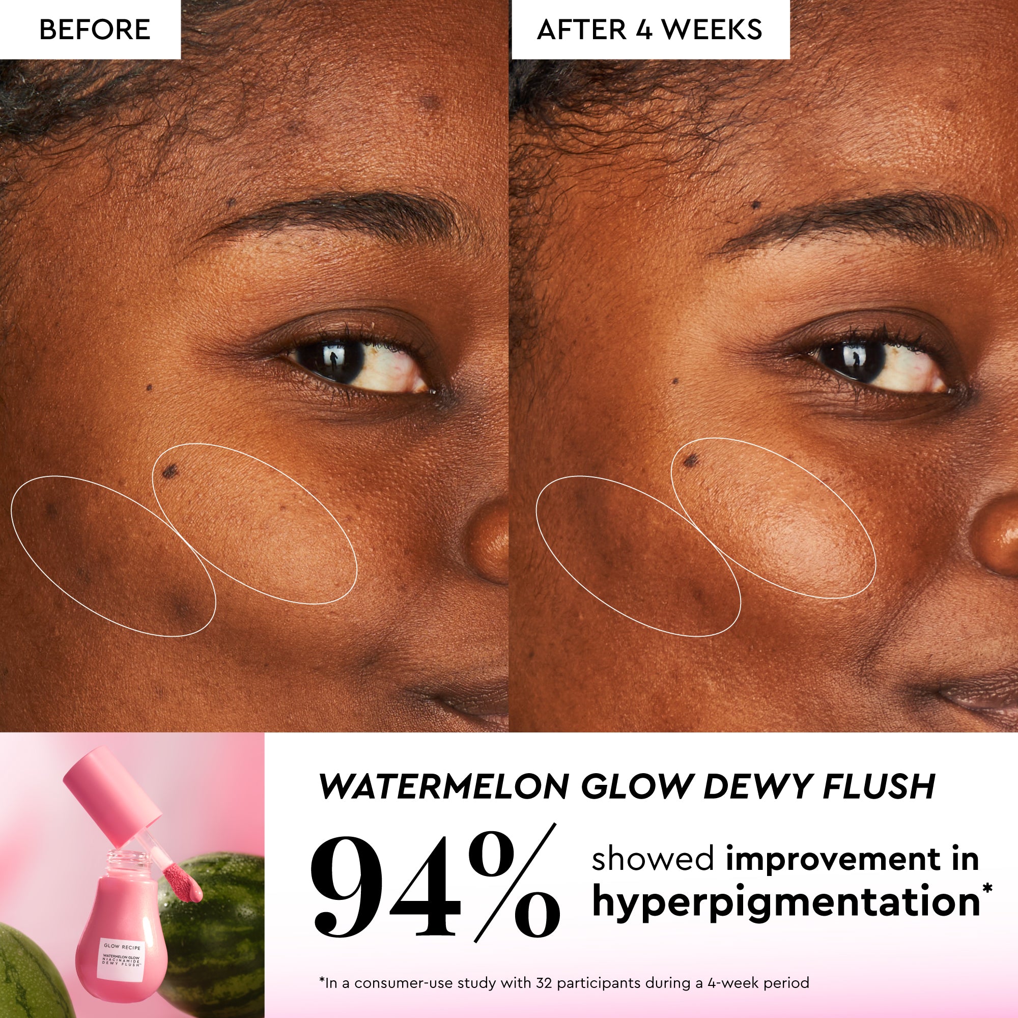glow-recipe-watermelon-glow-best-sellers-kit-with-beautyblender-3-deluxe-minis-e image 7