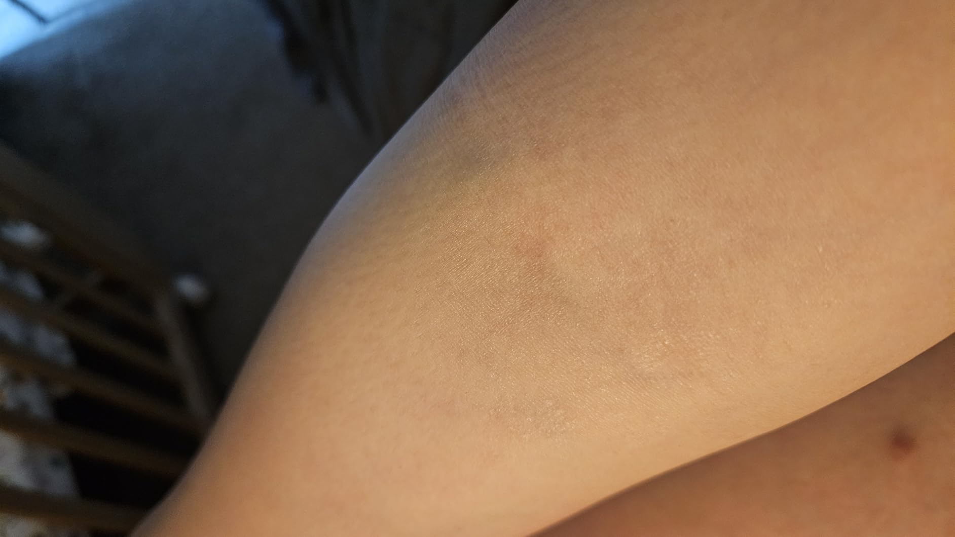 Helps with itching