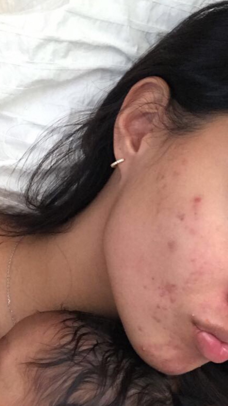 Great for oily skin