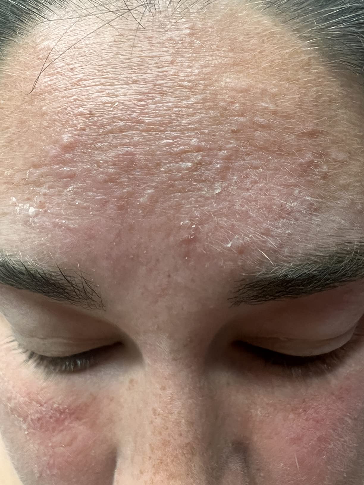 Brightening gel moisturizer