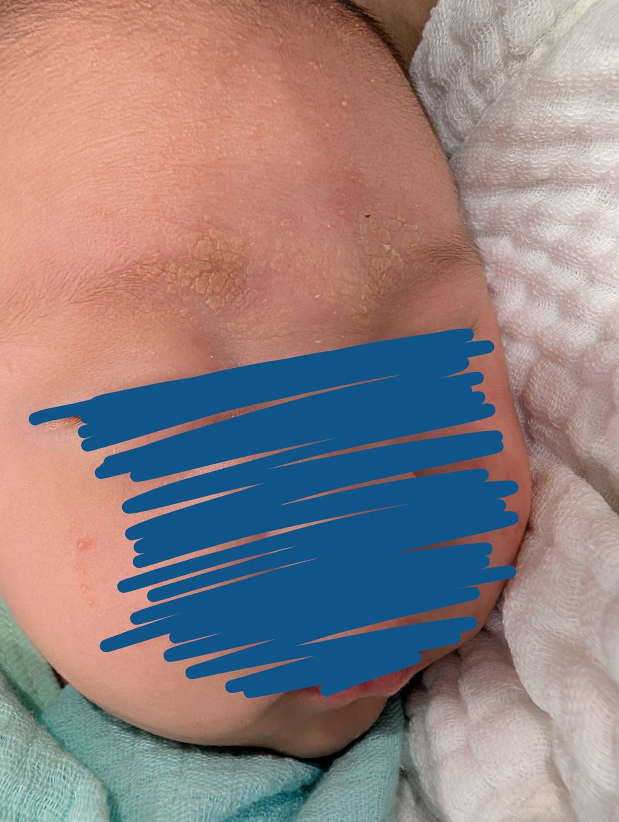 Saved my baby's skin