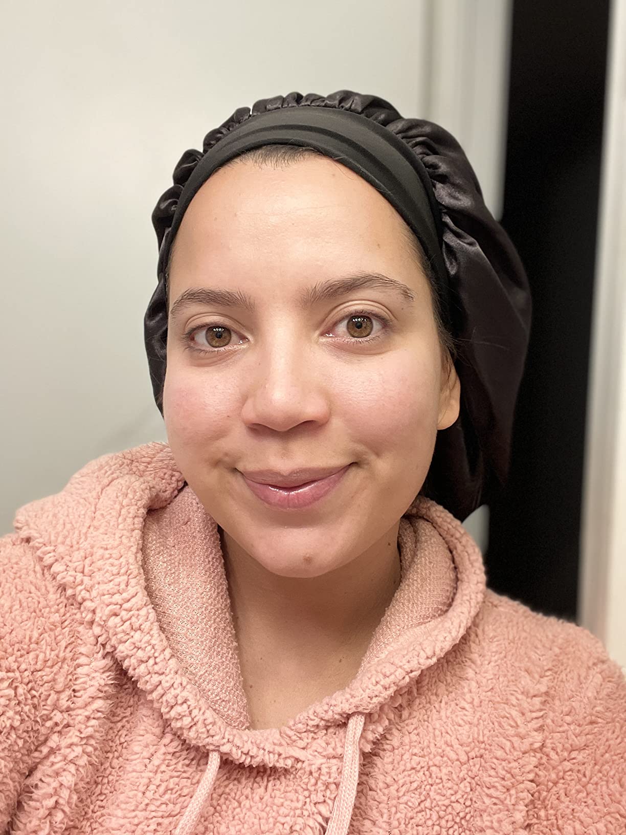 Acne cleared up