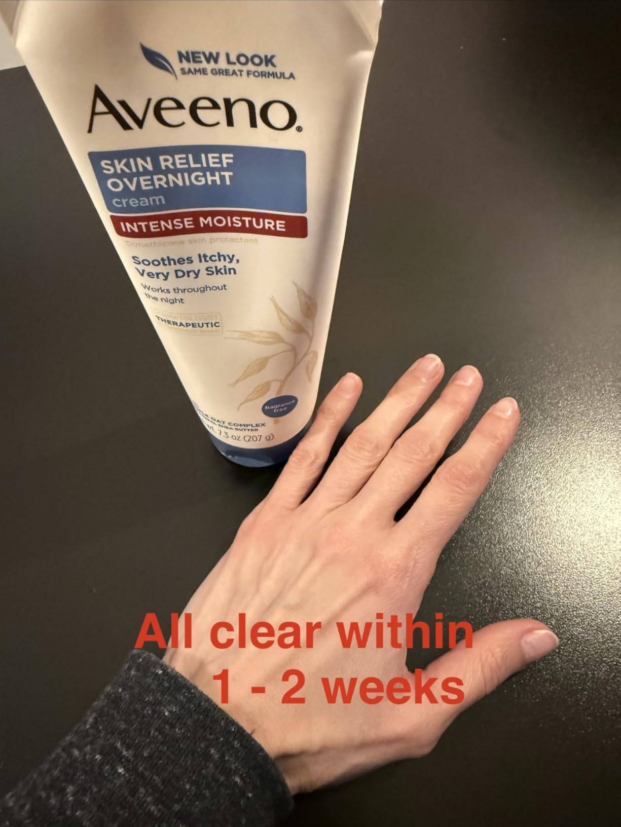 Game-changer for dry skin