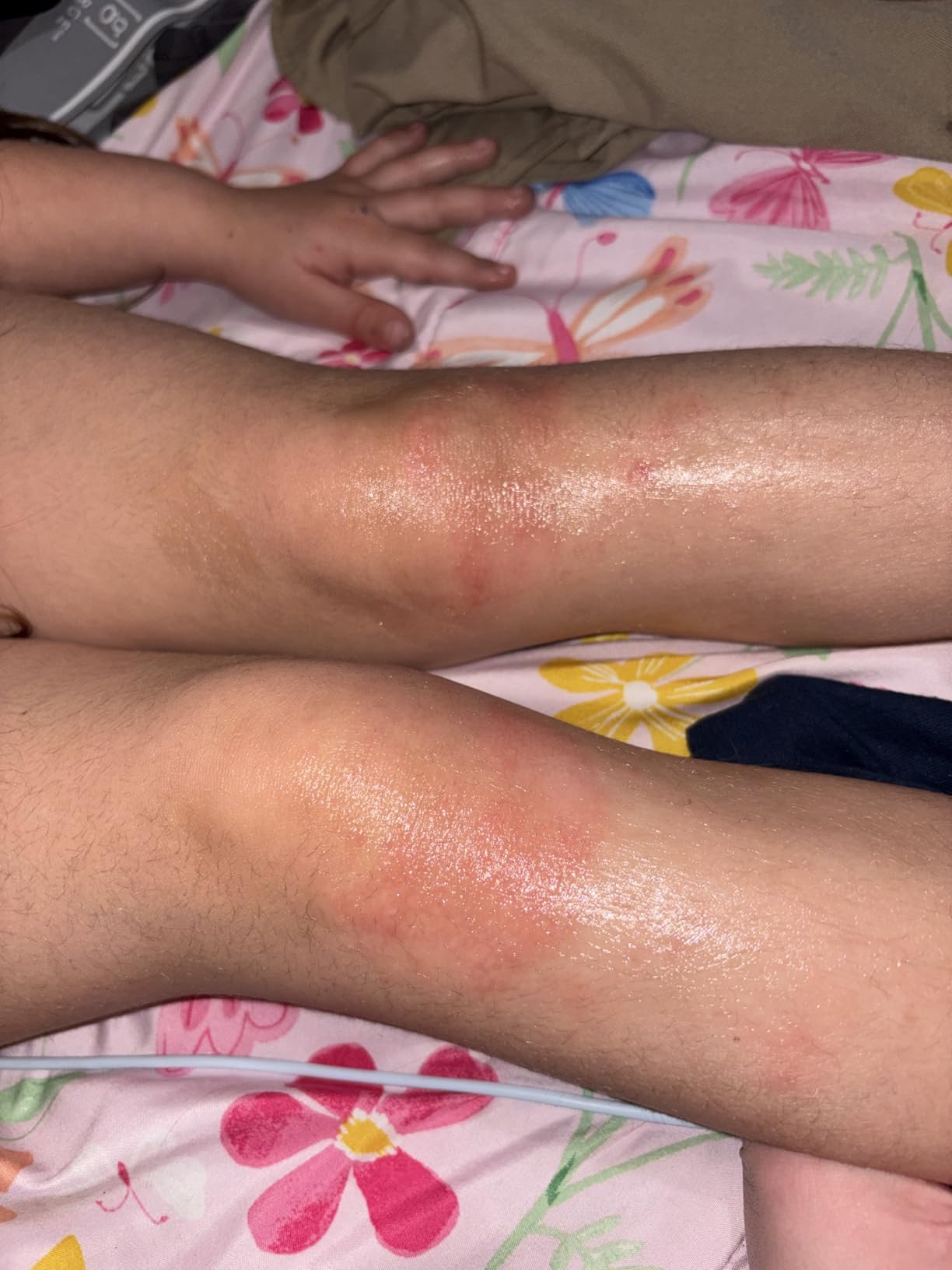 Overnight relief