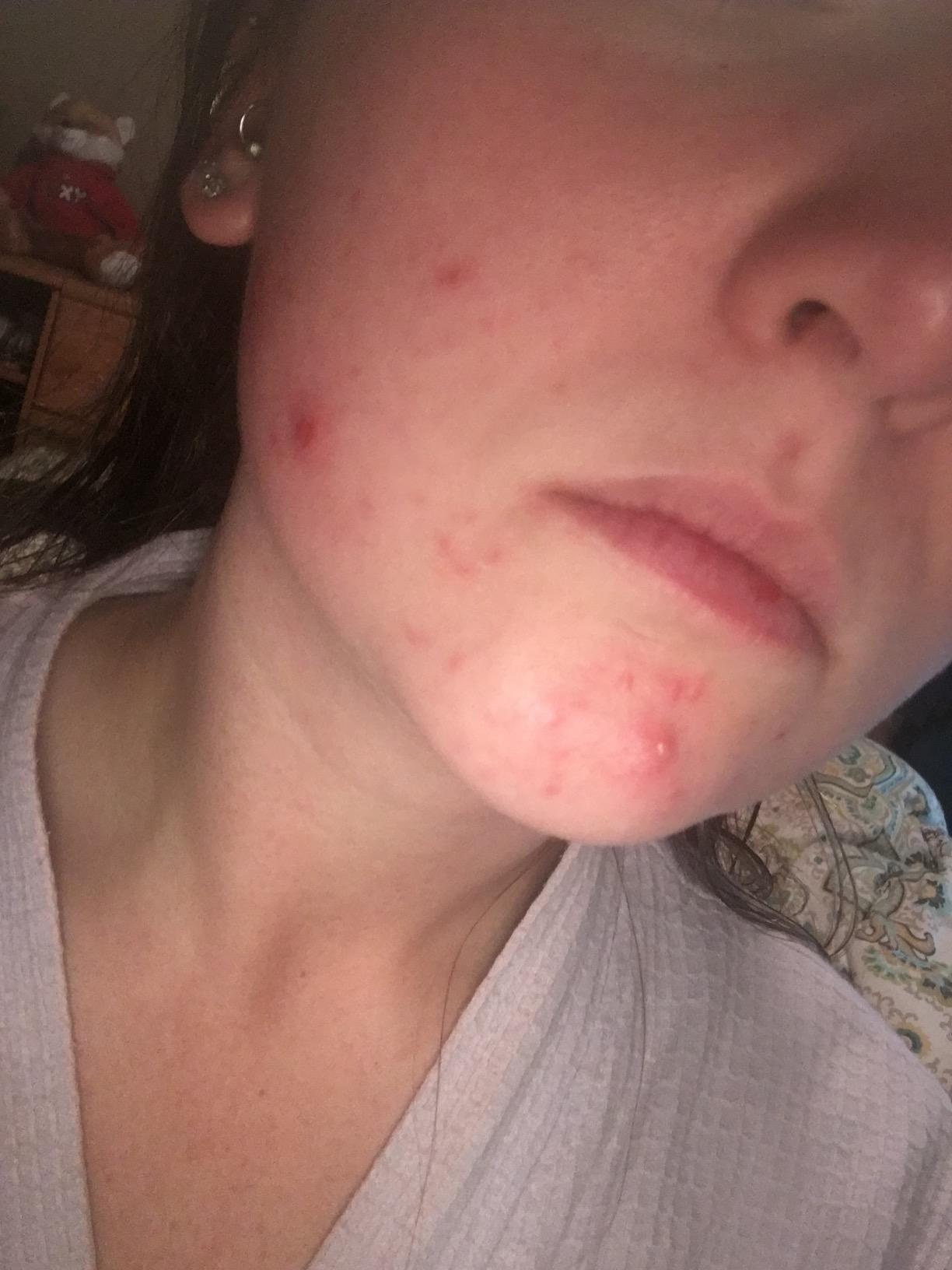 Impressive results