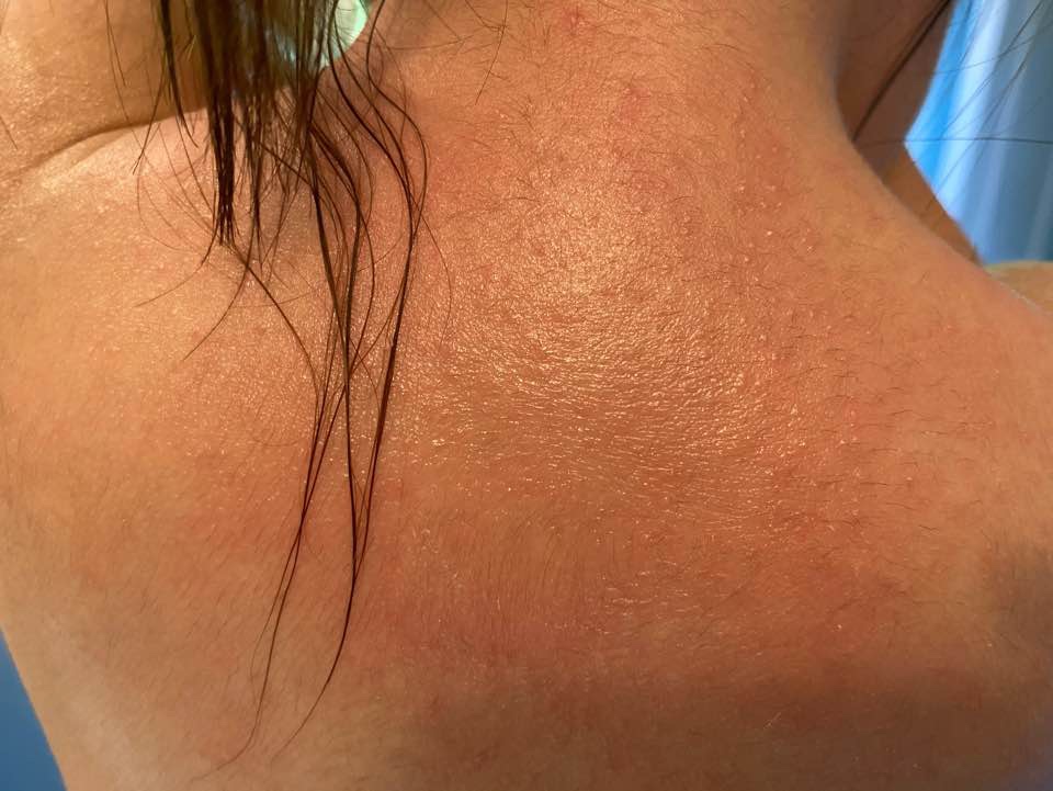 Good, but not for extremely dry skin
