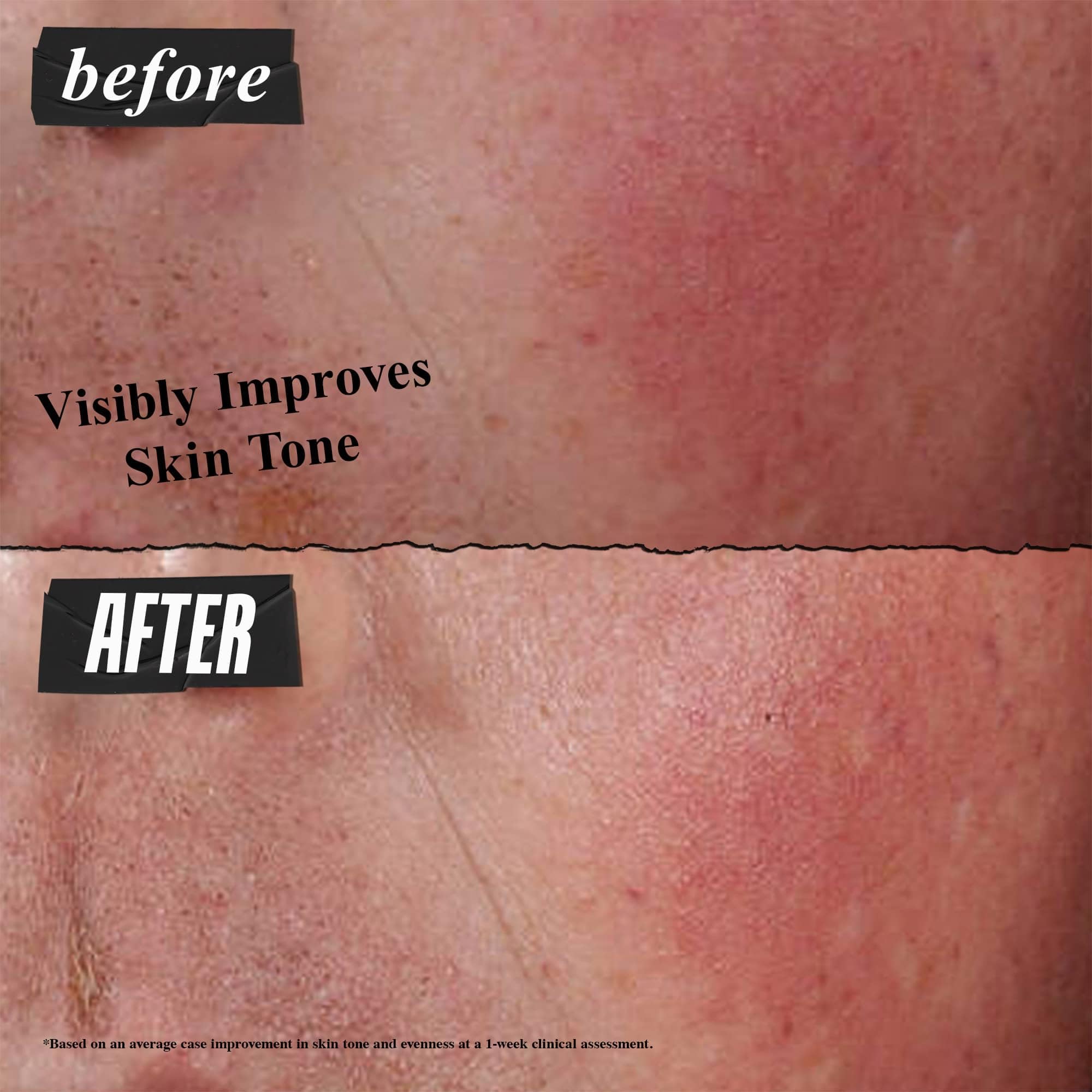 kiehl-s-ultra-facial-advanced-repair-barrier-cream-intensive-treatment-for-dry-s image 4