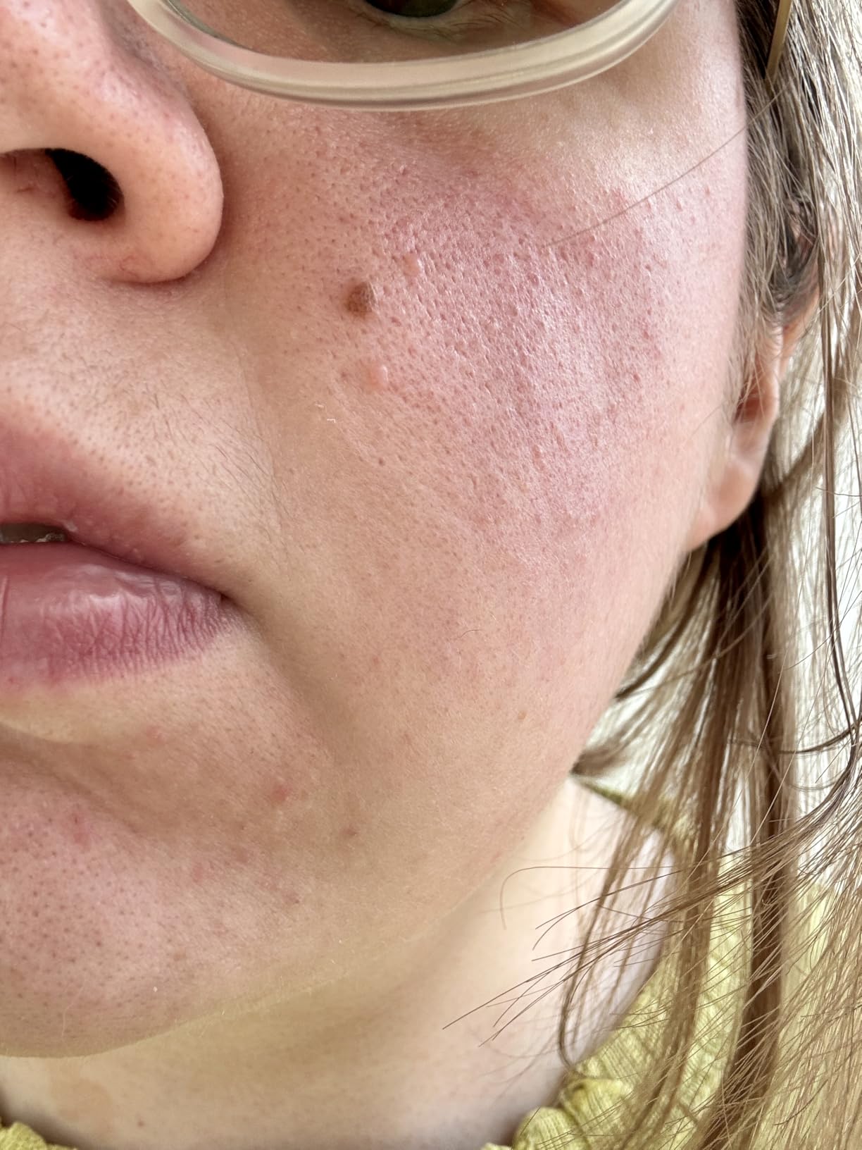Smooth skin in just a week