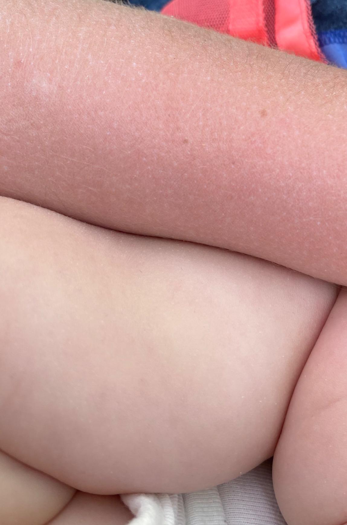 Tear-free and gentle