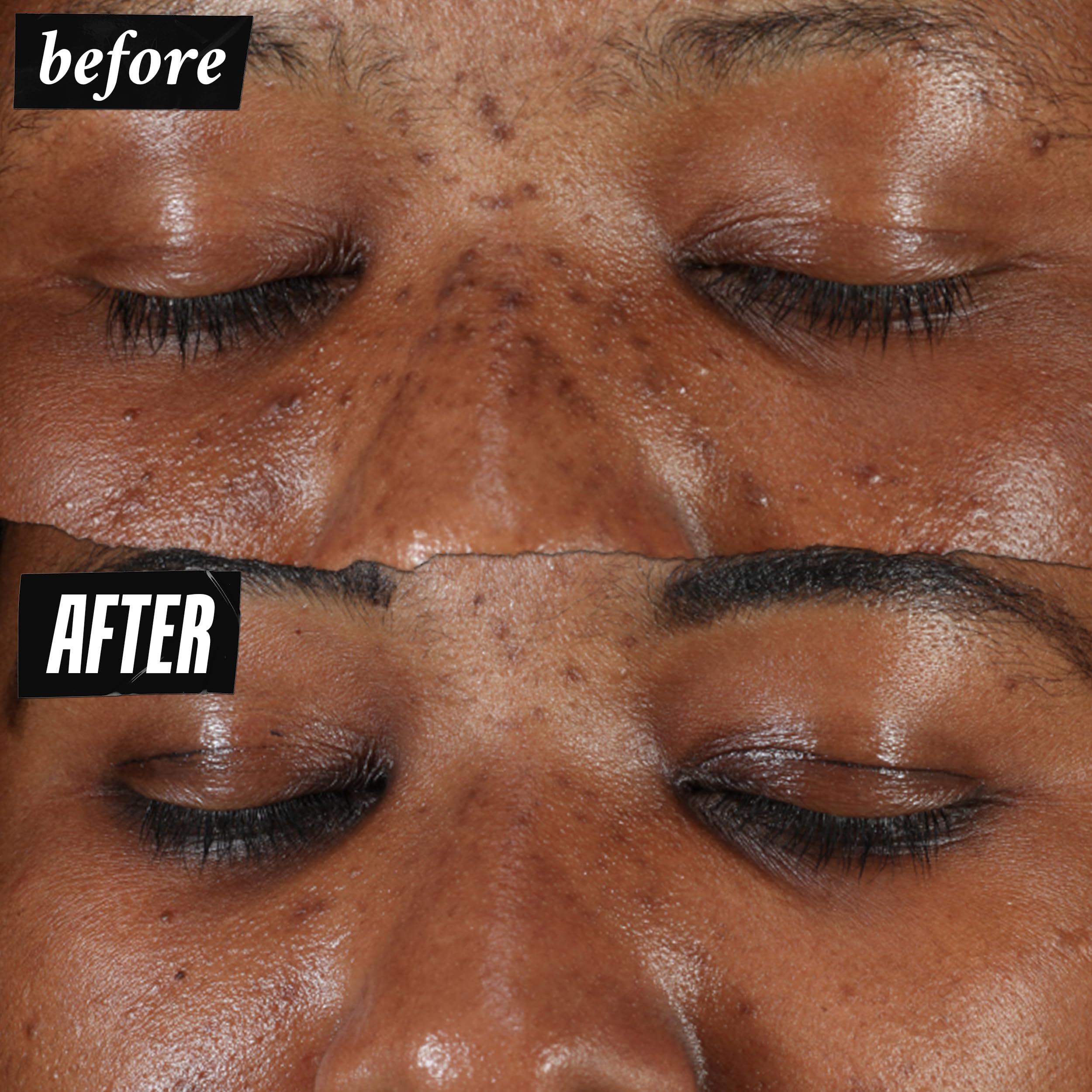 kiehl-s-clearly-corrective-dark-spot-serum-brightening-facial-serum-with-vitamin image 3