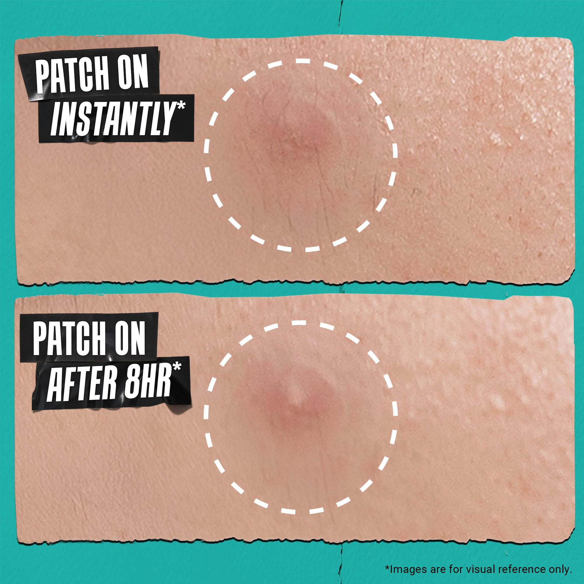 kiehl-s-overnight-pimple-patches-truly-targeted-invisible-hydrocolloid-blemish-p image 5