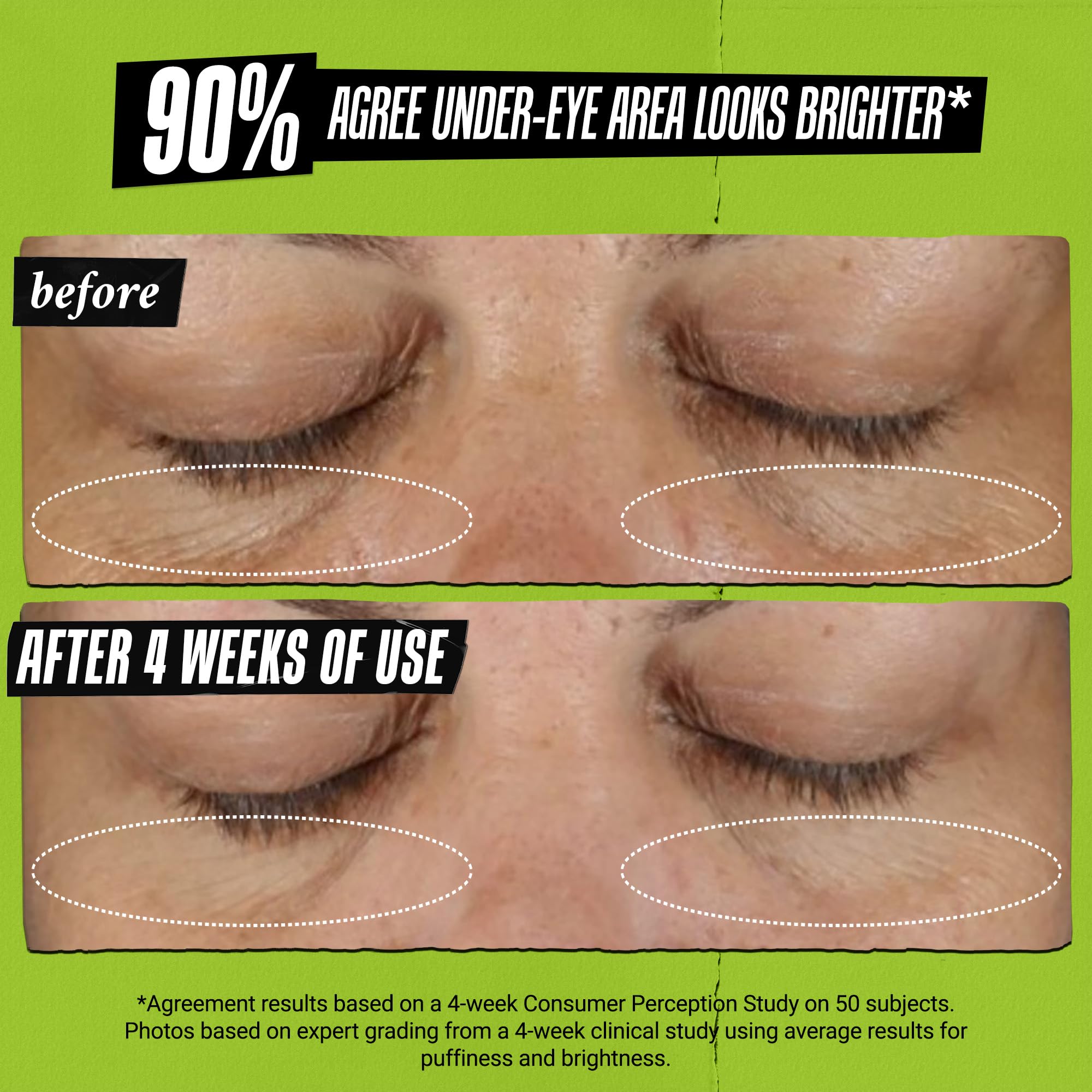 kiehl-s-avocado-eye-treatment-under-eye-cream-for-puffiness-and-dark-circles-wit image 5