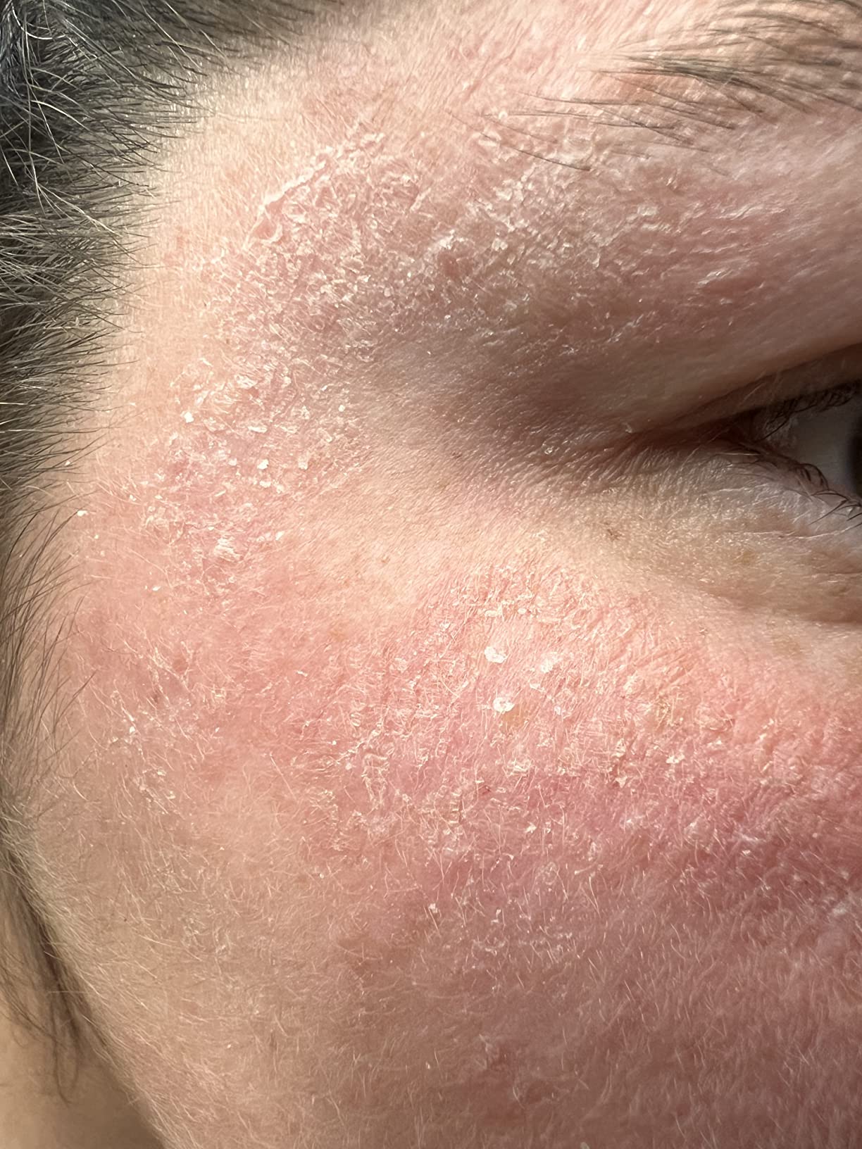 Hydrating and brightening