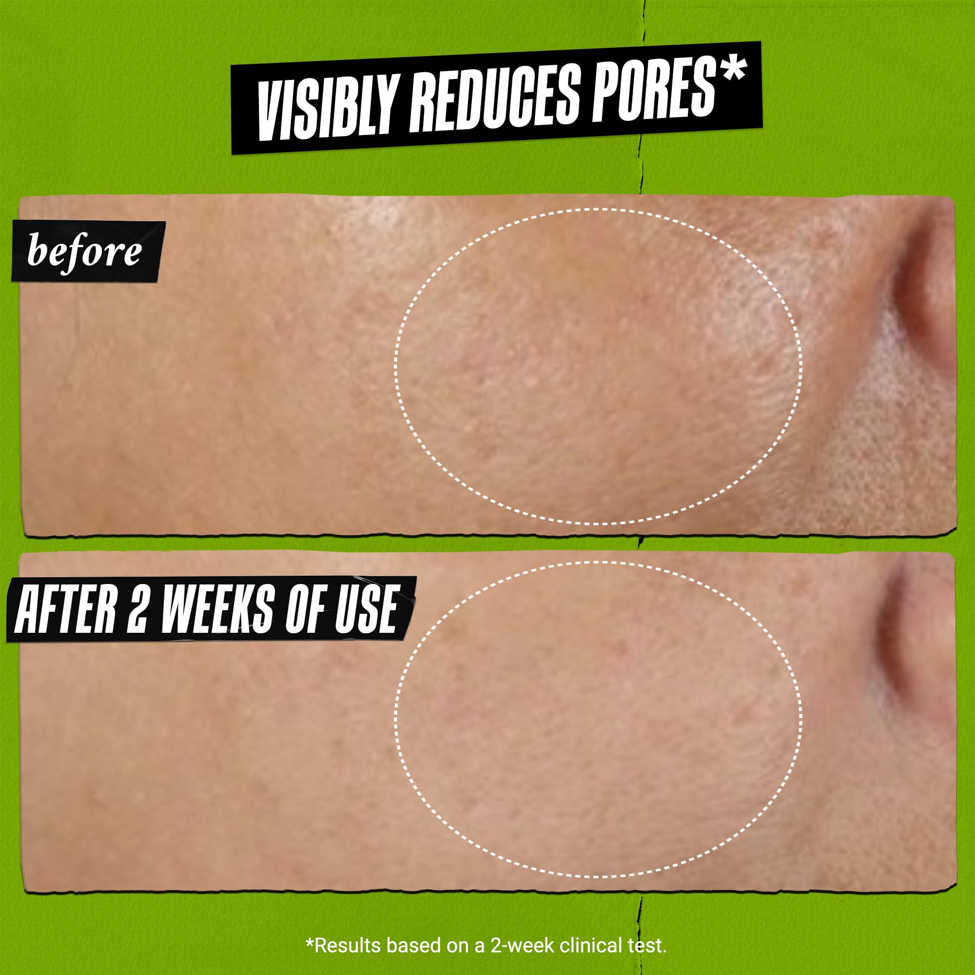 kiehl-s-rare-earth-deep-pore-cleansing-face-mask-pore-minimizing-clay-mask-with- image 3