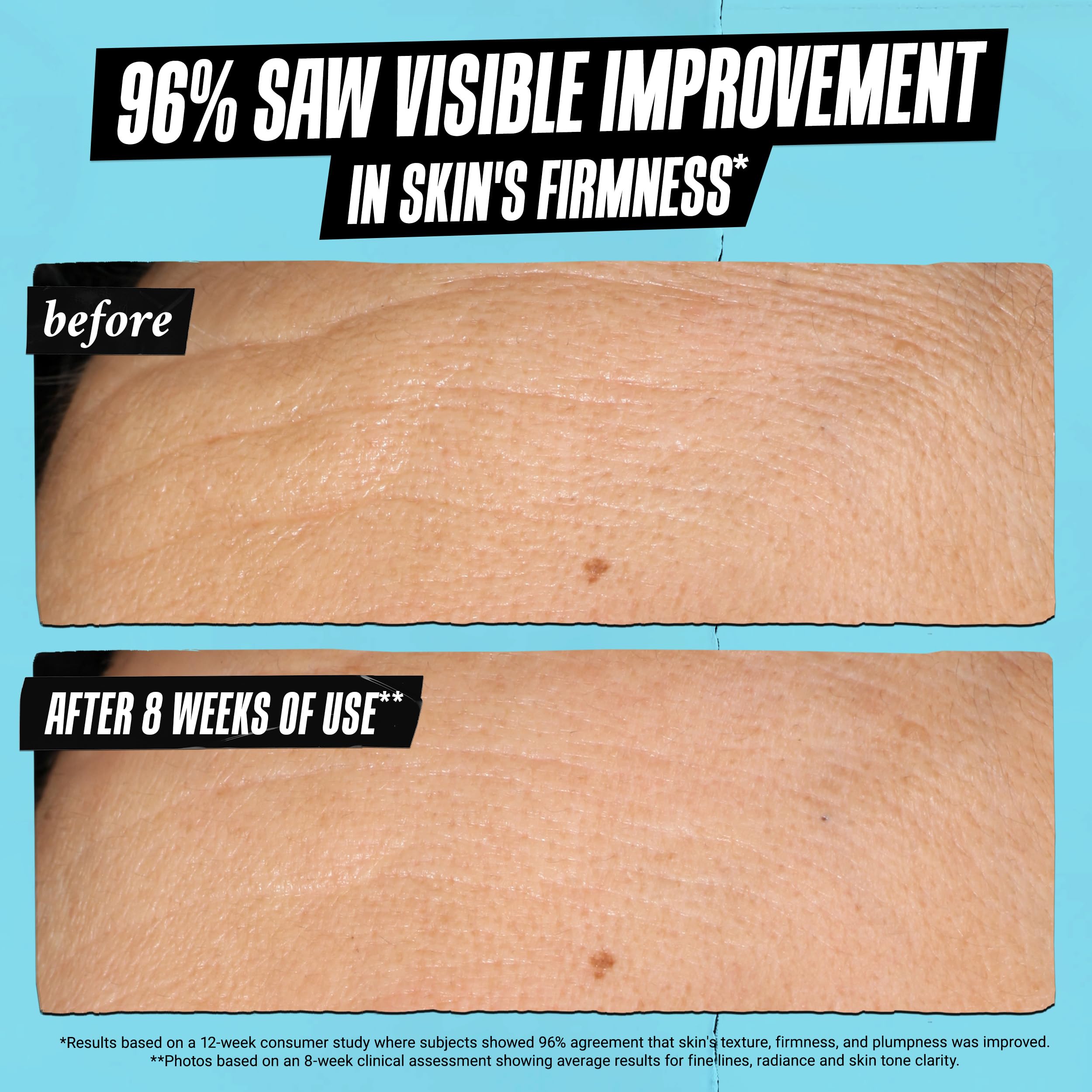 kiehl-s-super-multi-corrective-soft-cream-anti-aging-moisturizer-for-oily-combin image 3