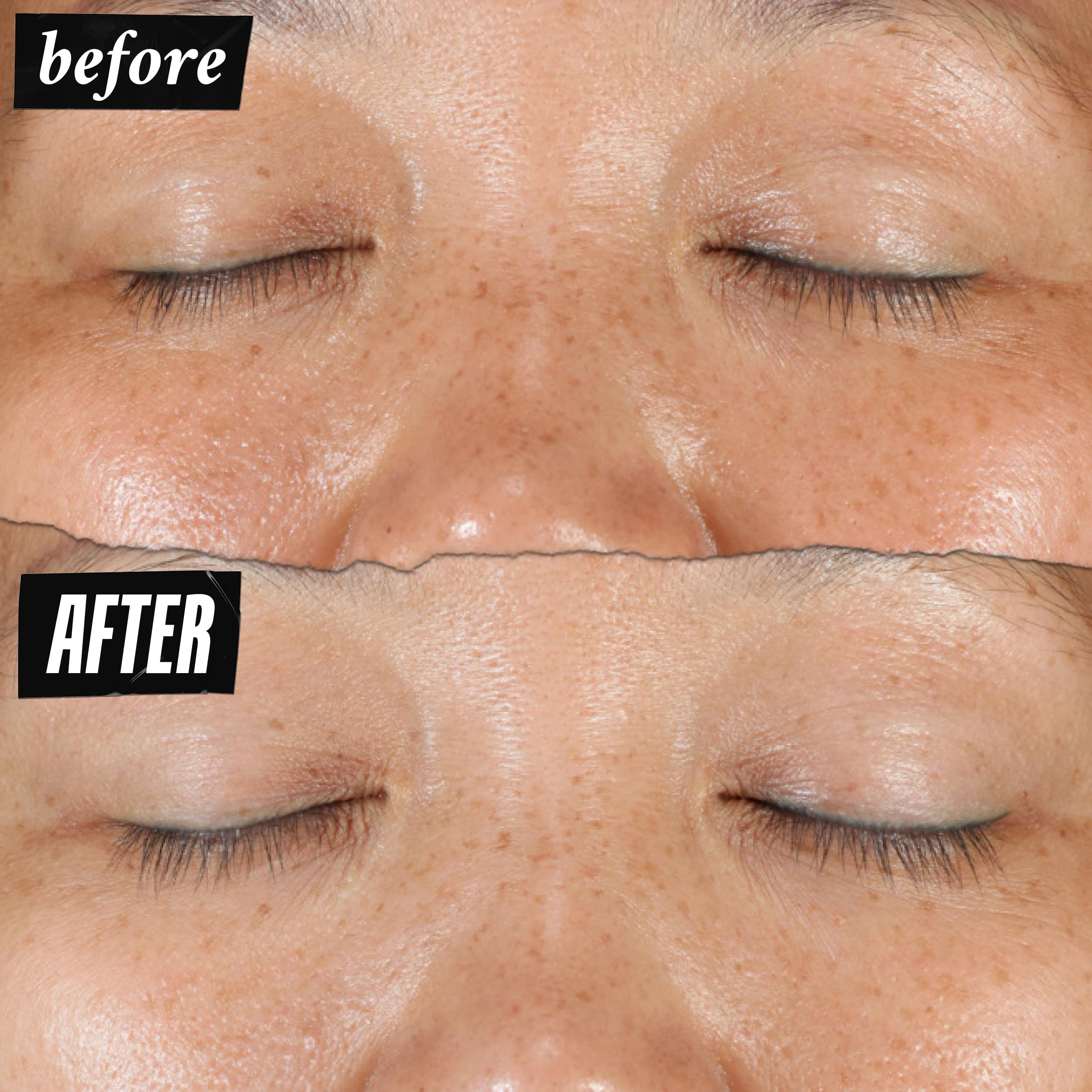 kiehl-s-clearly-corrective-dark-spot-serum-brightening-facial-serum-with-vitamin image 4