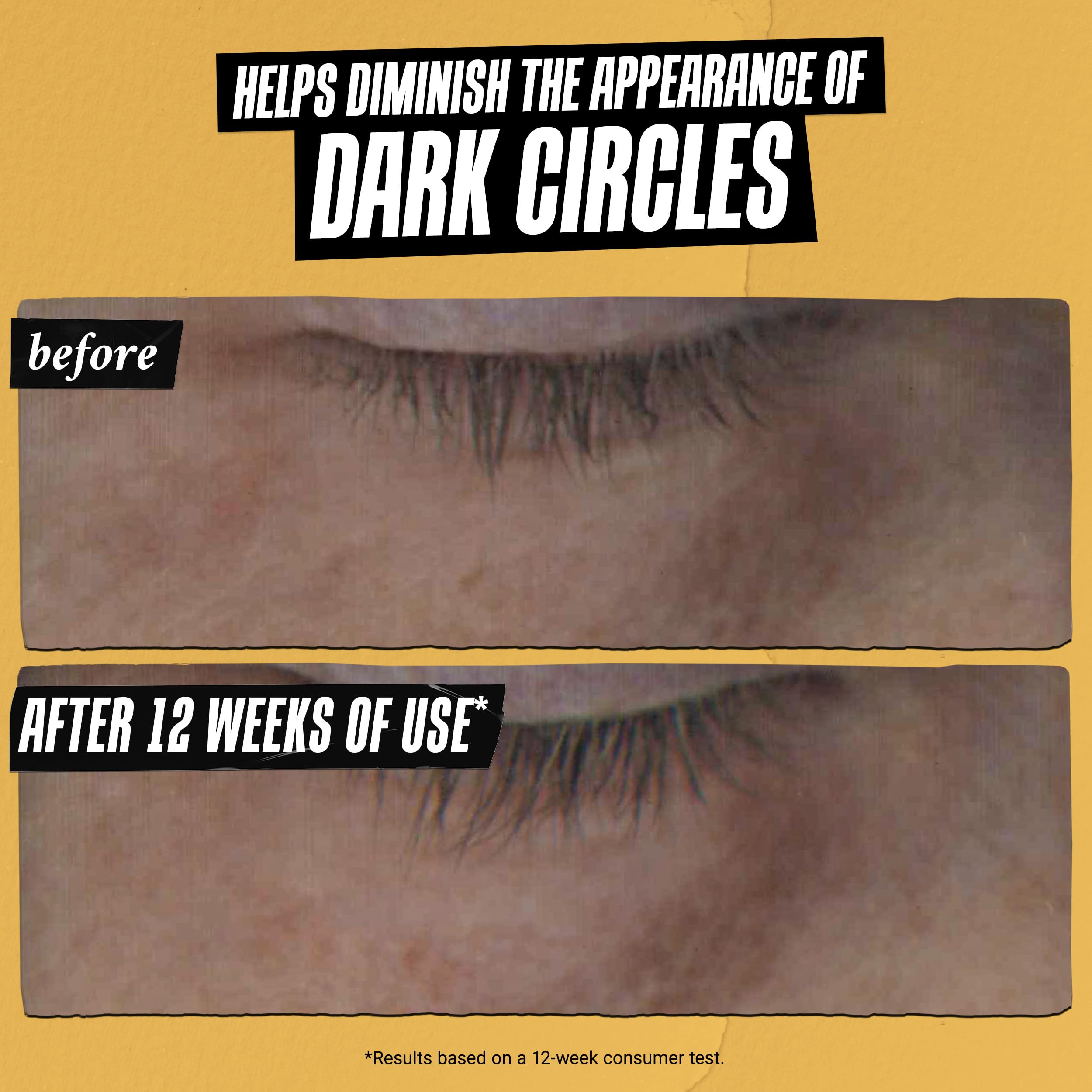 kiehl-s-powerful-strength-10-vitamin-c-eye-serum-line-reducing-dark-circle-dimin image 3