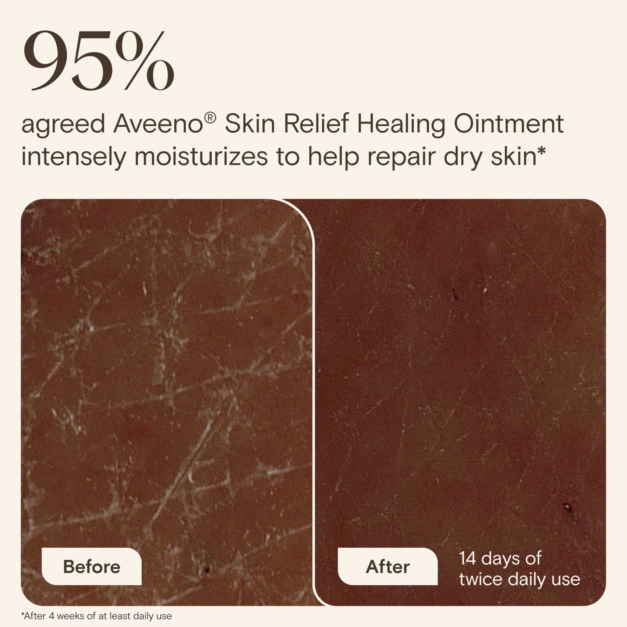 aveeno-skin-relief-healing-ointment-fragrance-free-for-extra-dry-cracked-sensiti image 2