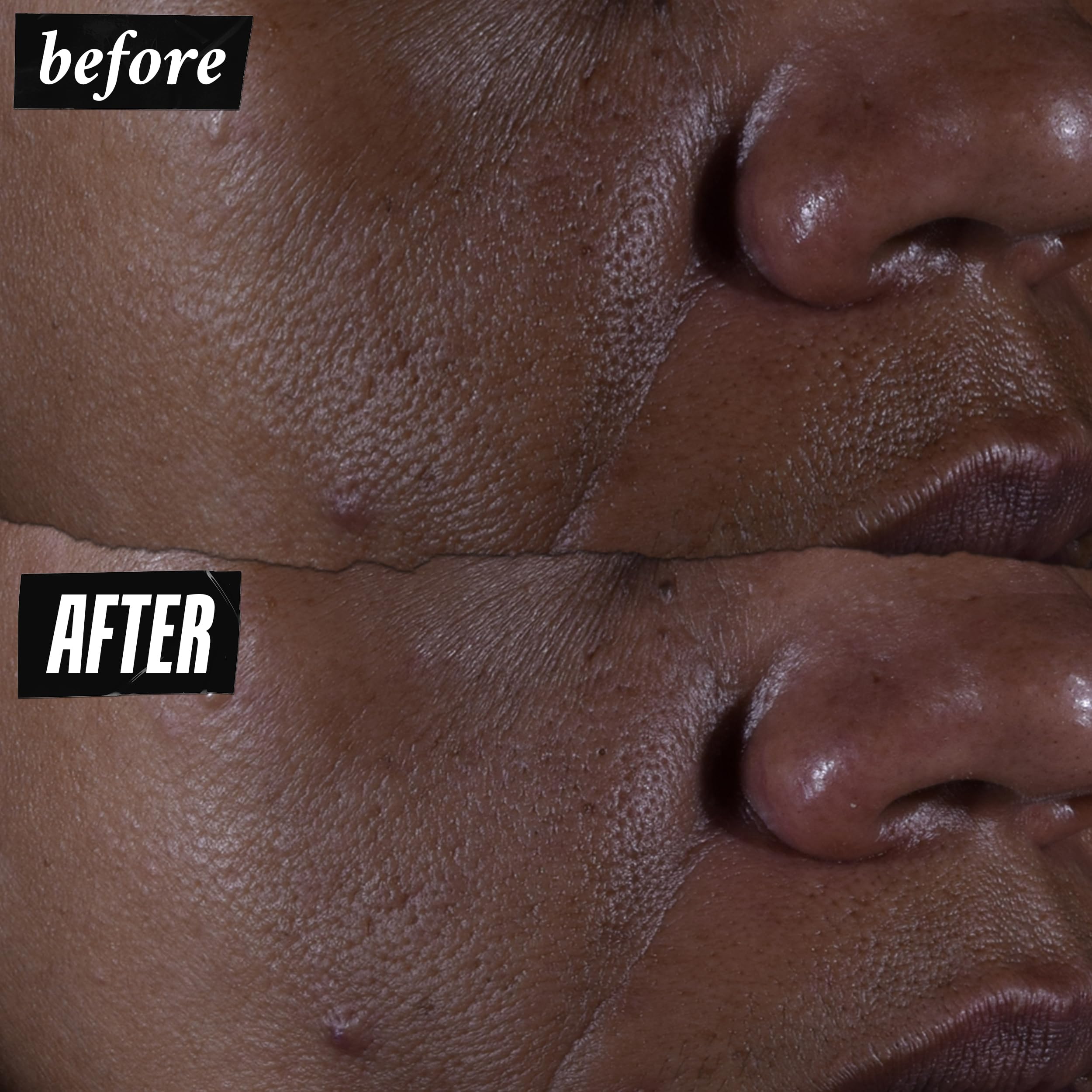 kiehl-s-ultra-pure-high-potency-9-8-glycolic-acid-serum-exfoliating-face-serum-f image 3