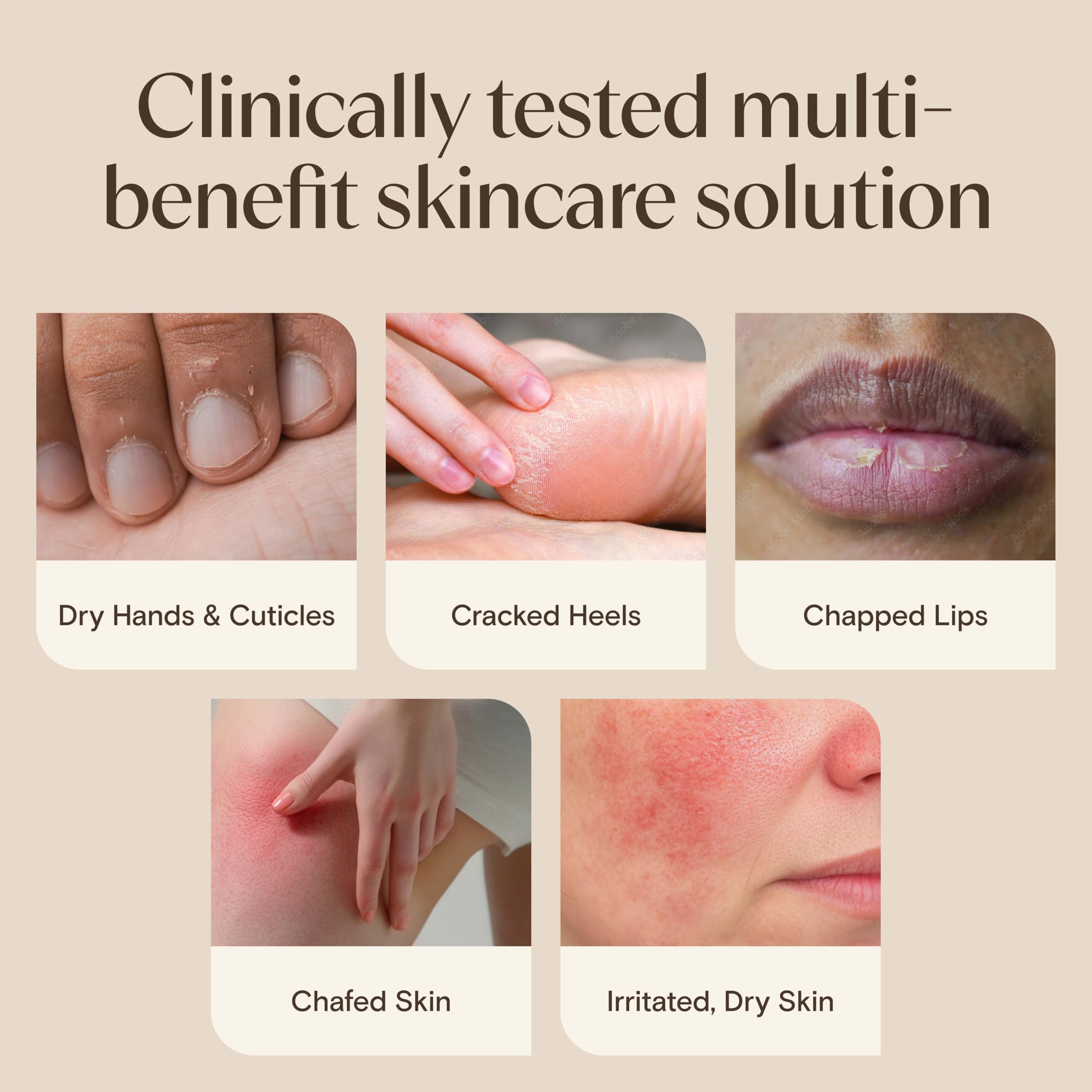 aveeno-skin-relief-healing-ointment-fragrance-free-for-extra-dry-cracked-sensiti image 5