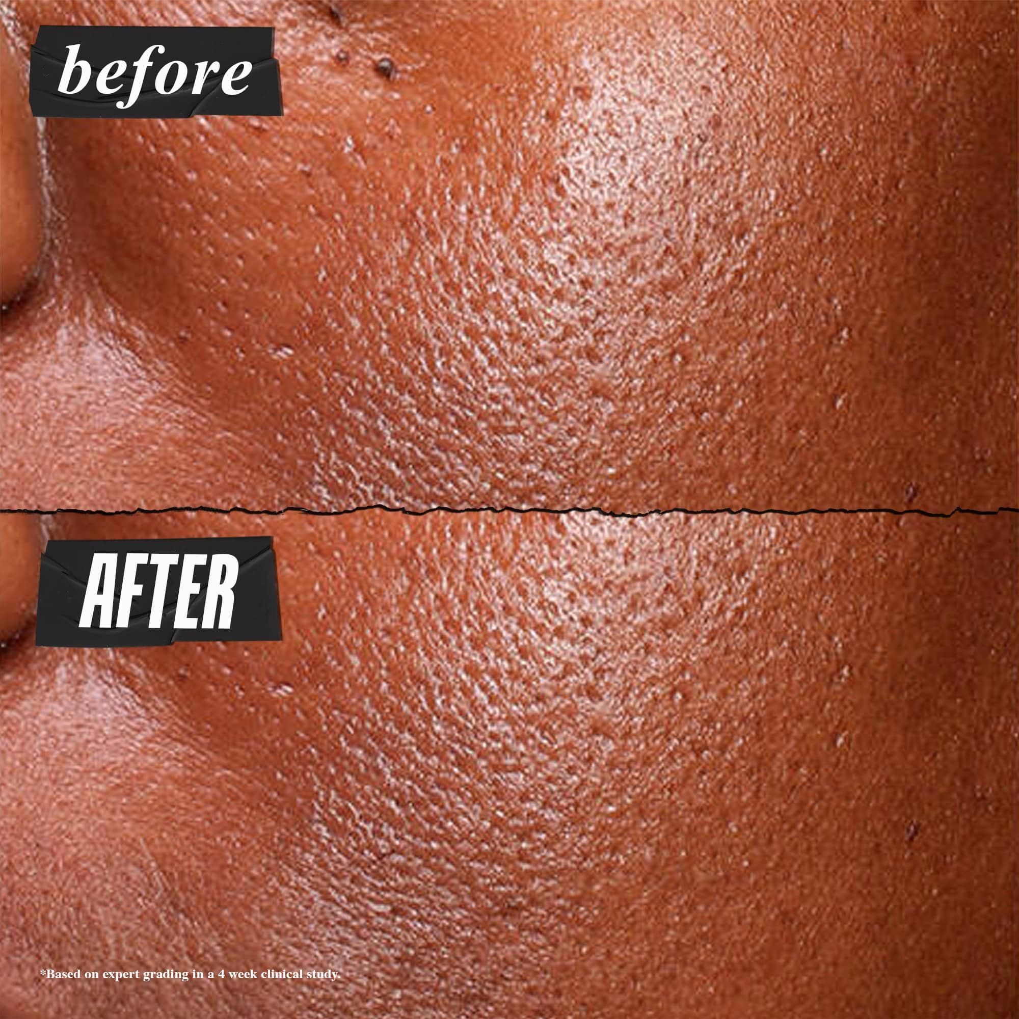 kiehl-s-ultra-pure-high-potency-5-0-niacinamide-serum-concentrated-face-serum-fo image 3