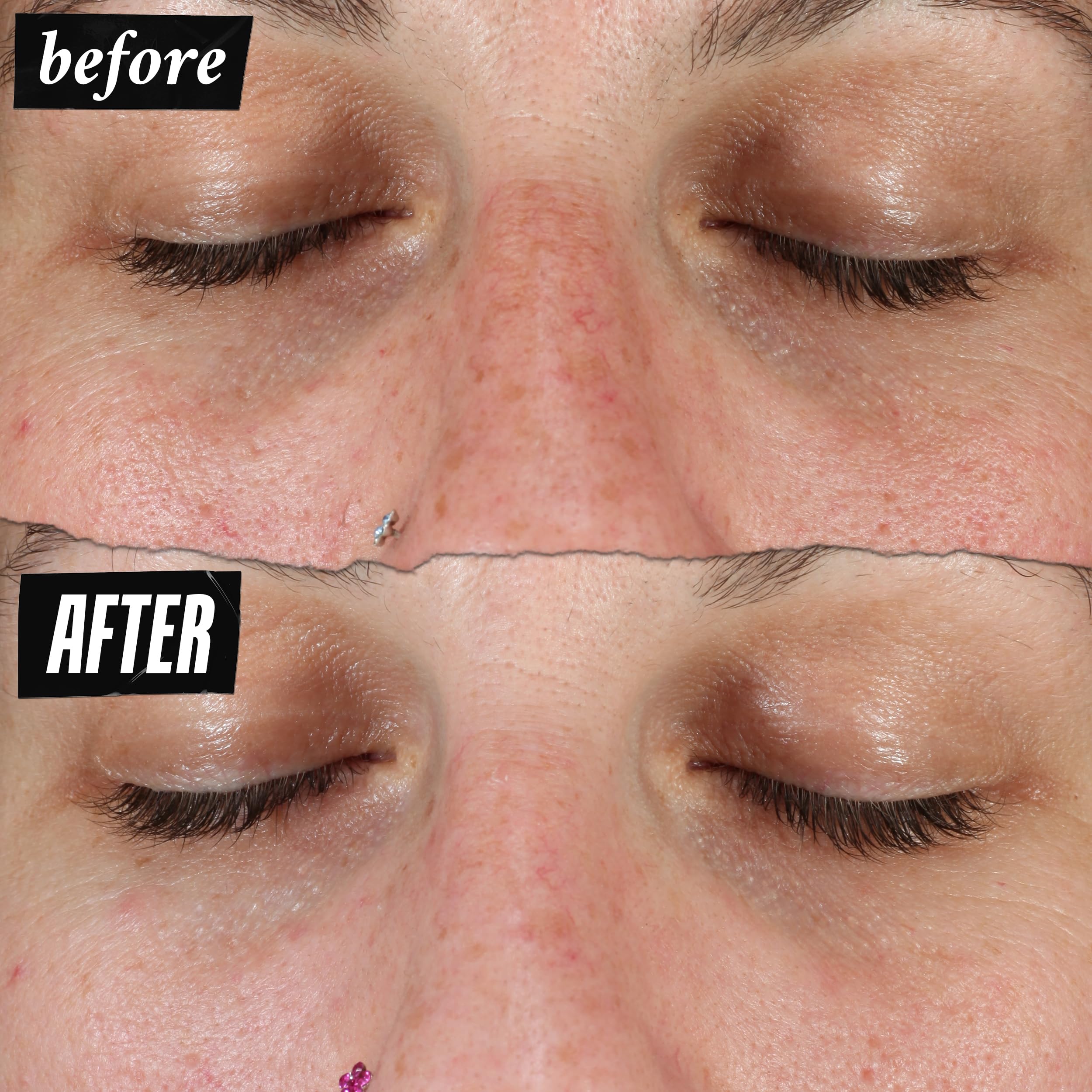 kiehl-s-clearly-corrective-dark-spot-serum-brightening-facial-serum-with-vitamin image 5