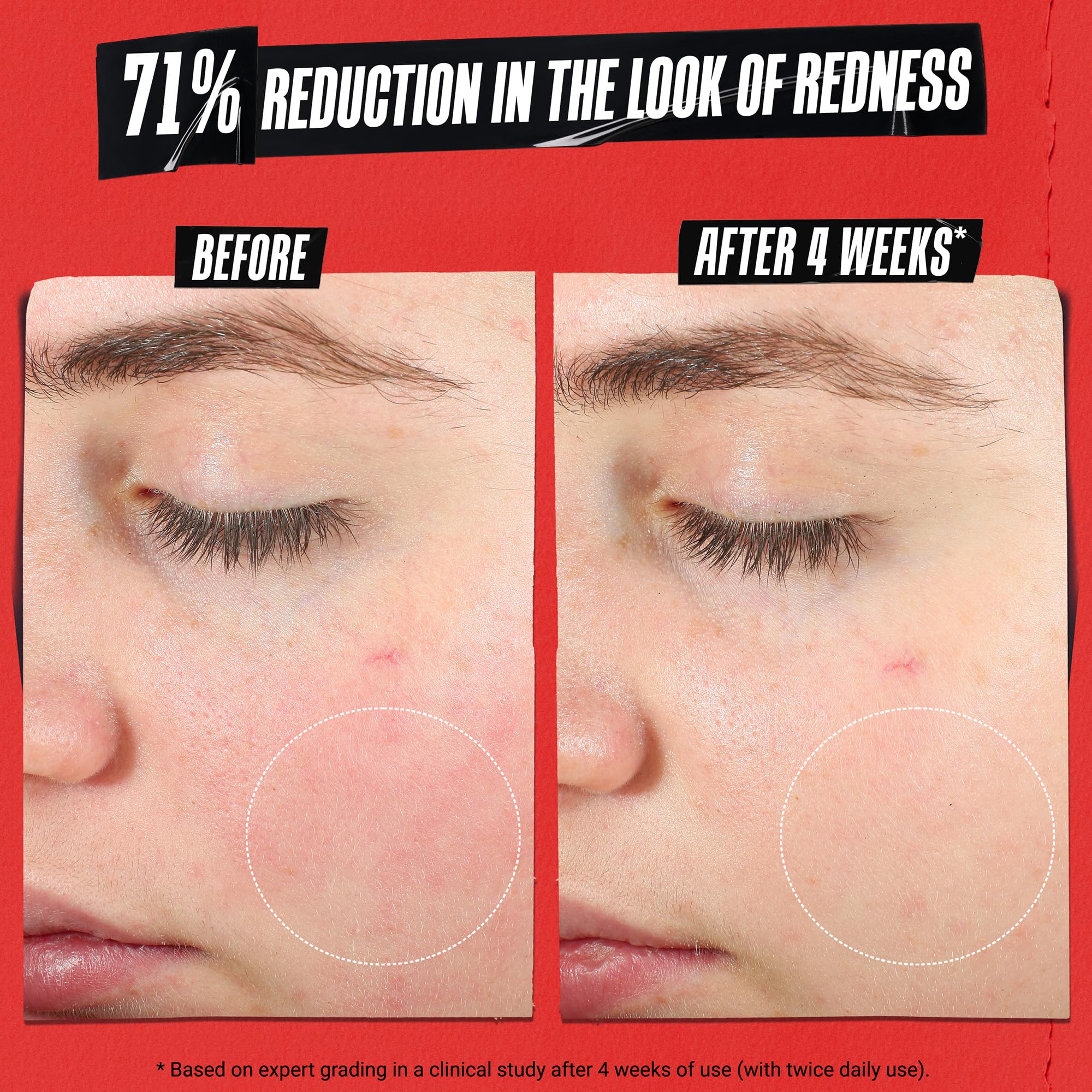 kiehl-s-ultra-facial-recovery-barrier-cream-lightweight-moisturizer-for-dry-sens image 2