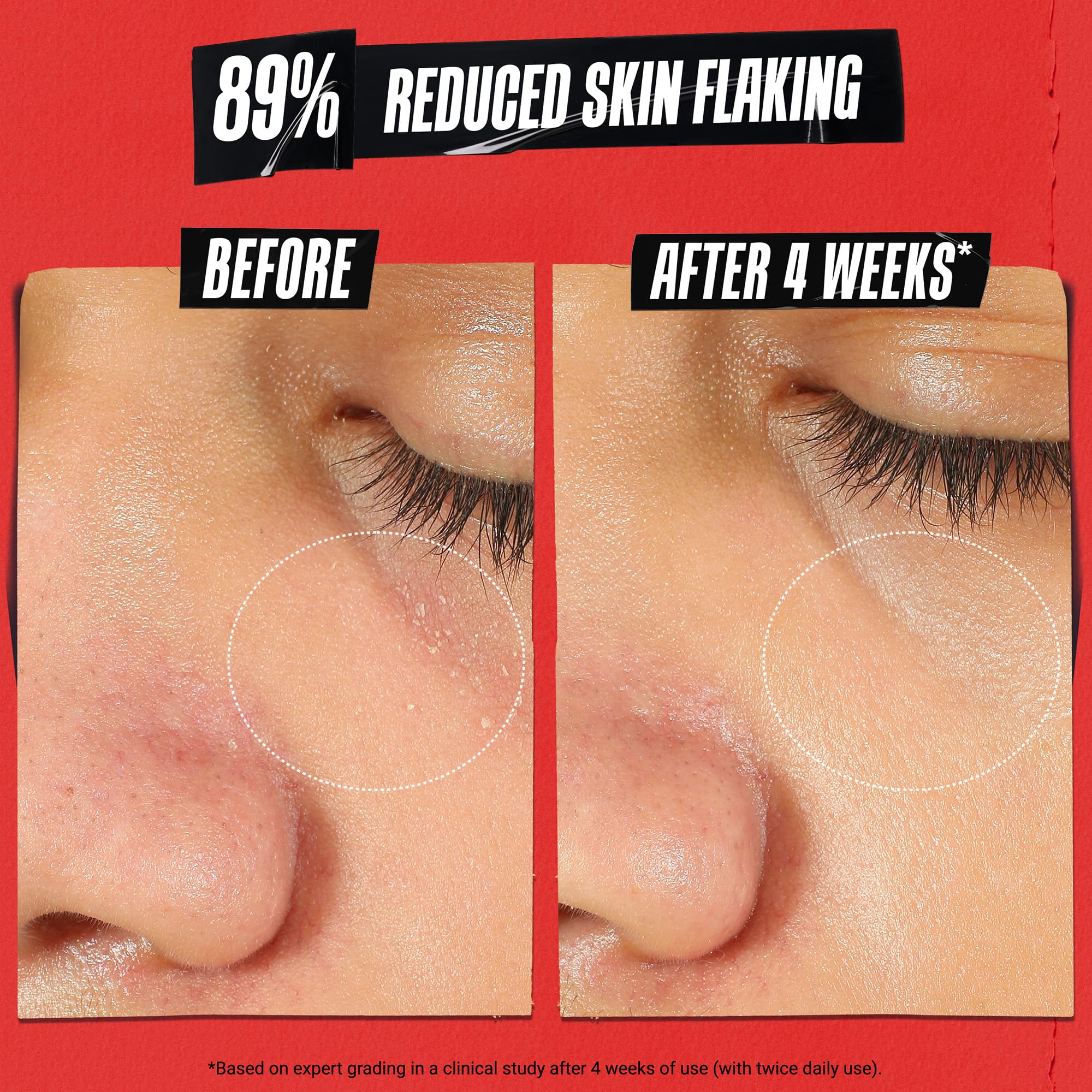kiehl-s-ultra-facial-recovery-barrier-cream-lightweight-moisturizer-for-dry-sens image 3