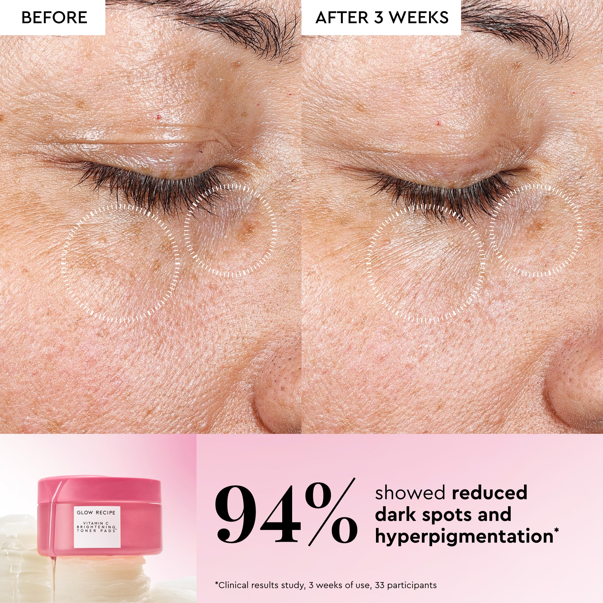 glow-recipe-vitamin-c-brightening-korean-toner-pads image 3